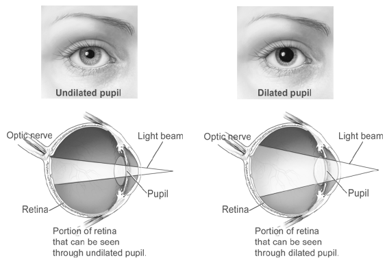 Disease Of Retina